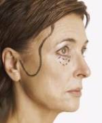 cosmetic surgery los angeles county.